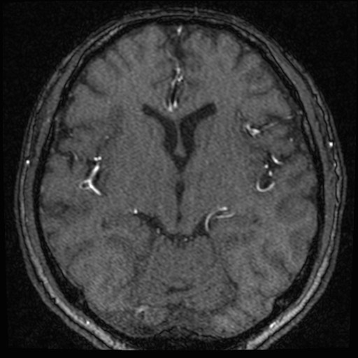 Click on the Serie image to view the images of VILLANUEVA, WILLIAM A.